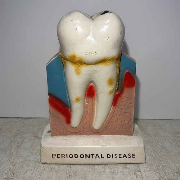 Procter & Gamble Vintage Tooth Model for Gingivitis 1960's (By Crest) - Picture 3 of 8